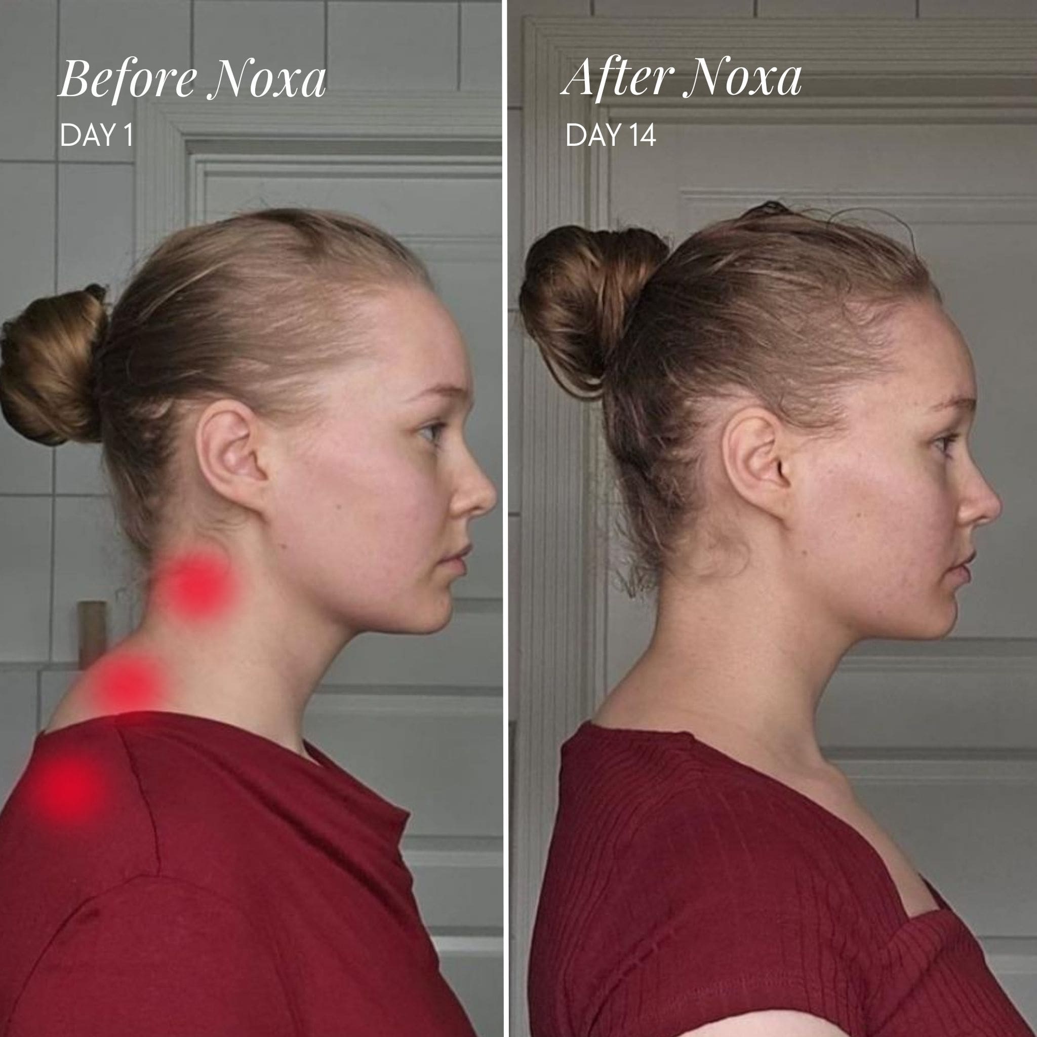 Knotheal Neck and Shoulder Massager